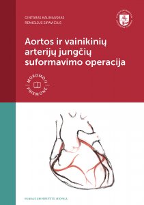 Aortos ir vainikinių arterijų jungčių suformavimo operacija