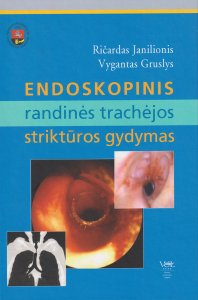 Endoskopinis randinės trachėjos striktūros gydymas