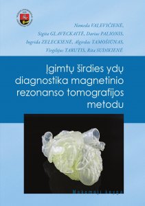 Įgimtų širdies ydų diagnostika magnetinio rezonanso tomografijos metodu