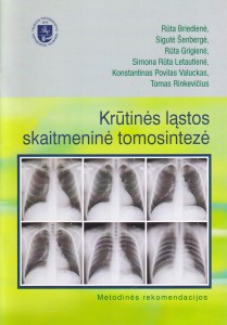 Krūtinės ląstos skaitmeninė tomosintezė