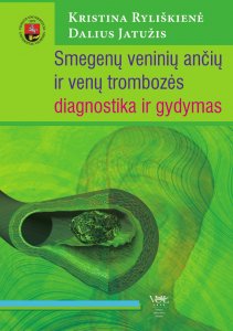 Smegenų veninių ančių ir venų trombozės diagnostika ir gydymas