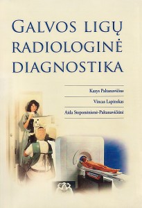 Galvos ligų radiologinė diagnostika
