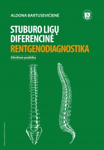 Stuburo ligų diferencinė rentgenodiagnostika. Klinikinė praktika